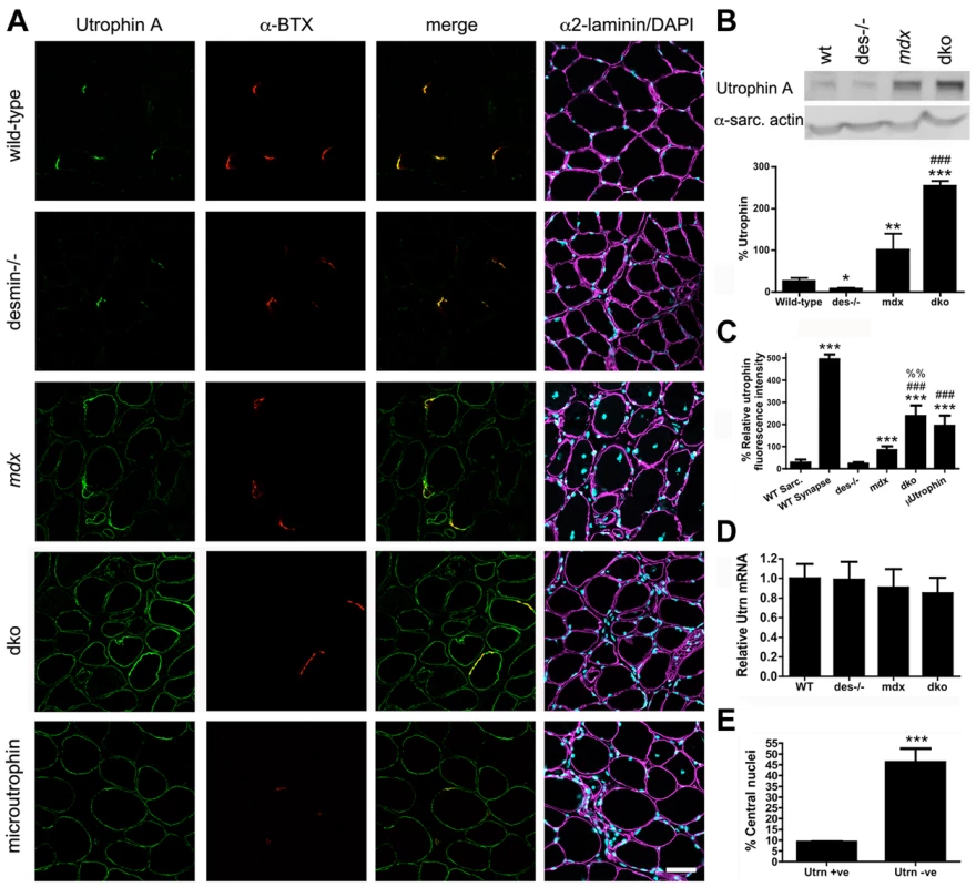 Expression and localization of utrophin in wild-type, desmin<sup>−/−</sup>, <i>mdx<sup>4cv</sup></i> and dko muscles at 11 weeks of age.