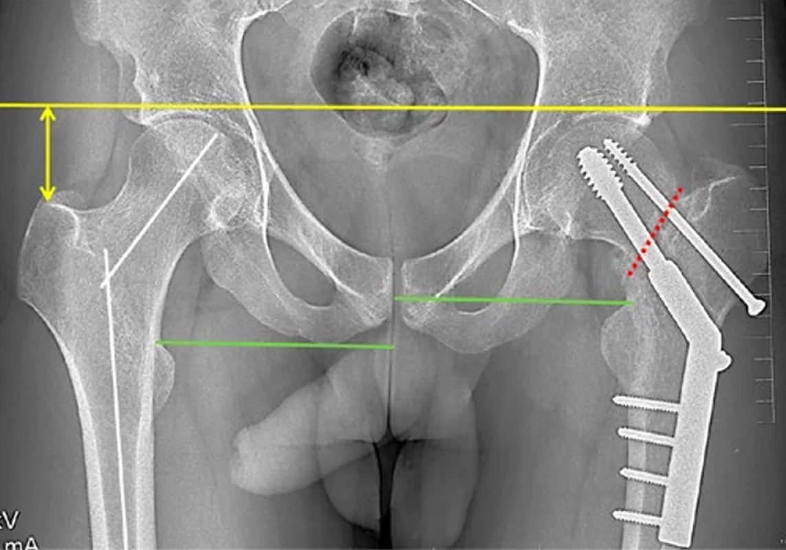 Fig. 3.
