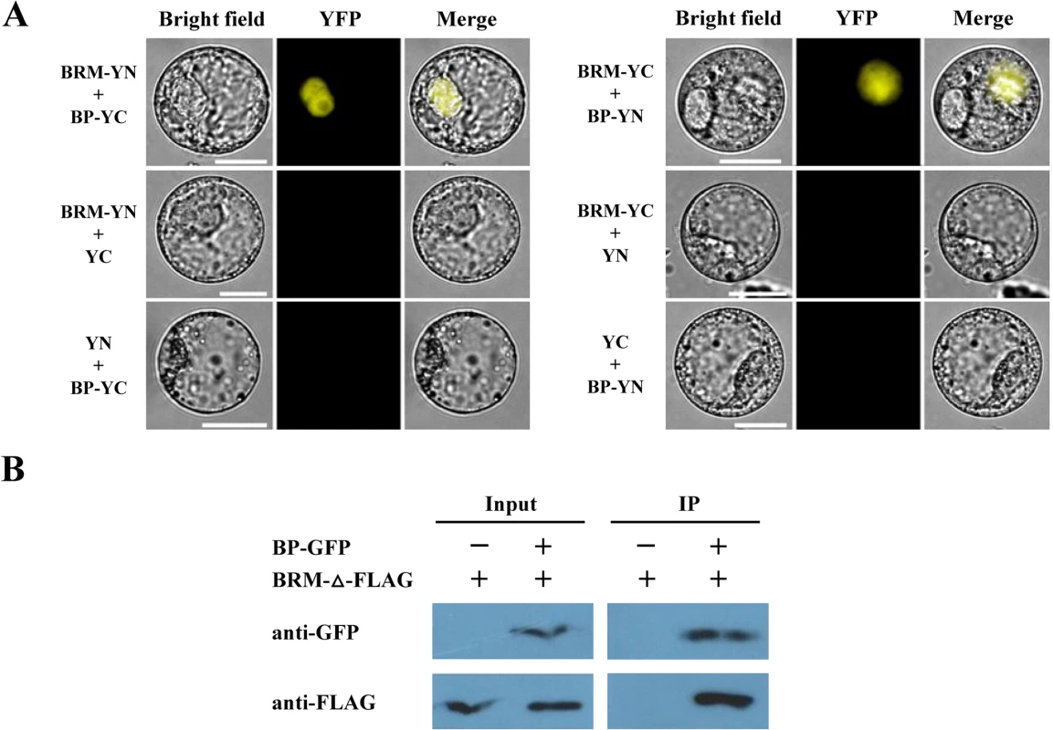 BRM interacts with BP <i>in vivo</i> detected by BiFC and Co-IP assays.