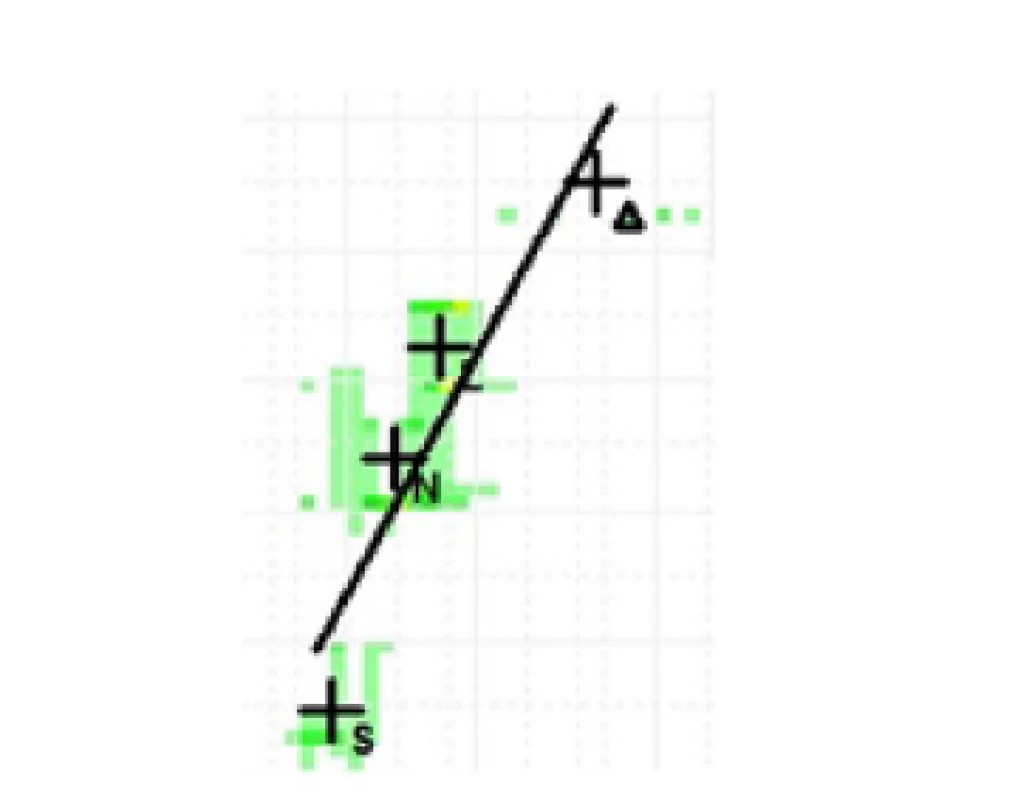 Příklad křivky profilu mluveného hlasu (speaking profile slope) pro hodnotu