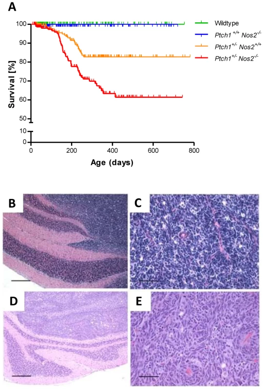 <i>Nos2</i> deficiency increases the incidence of MB in <i>Ptch1</i><sup>+/−</sup> mice.