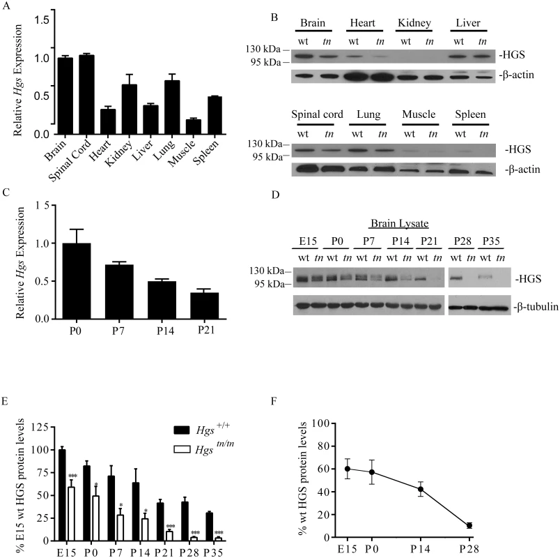 HGS expression in <i>Hgs</i><sup><i>+/+</i></sup> and <i>Hgs</i><sup><i>tn/tn</i></sup> tissues.