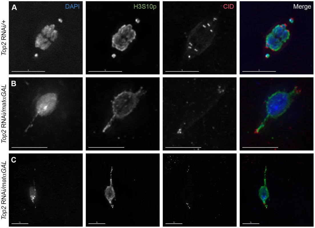 Centromeres are present within and near the tips of the DNA projections in <i>Top2</i> RNAi<i>/matαGAL</i> oocytes.