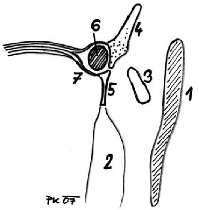 Axiální průřez vnitřním koutkem. 1 – concha nasi media, 2 –bulla ethmoidalis, 3 - processus uncinatus, 4 – processus frontalis maxillae, 5 – os lacrimale, 6 – saccus lacrimalis, 7 – ligamentum canthi mediale.

