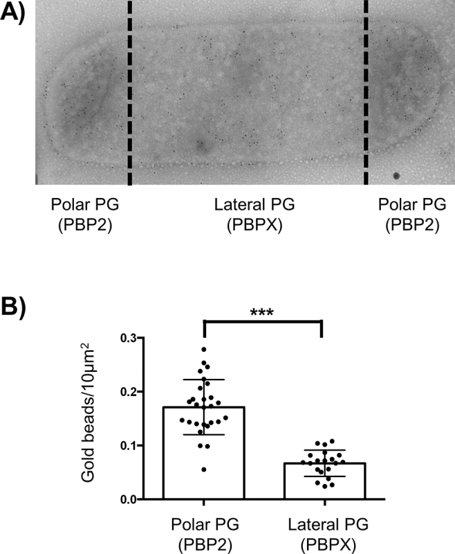 GM5 detection on polar and lateral PG.