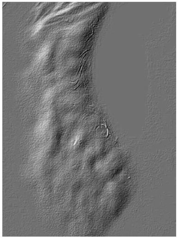 Fingerprints – otiskové změny