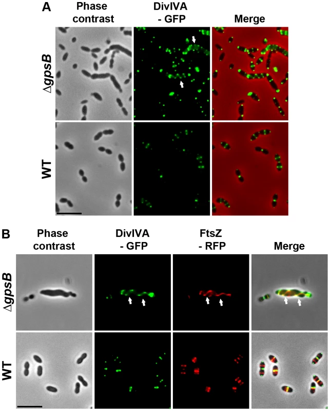Localization of DivIVA in WT and Δ<i>gpsB</i> cells.