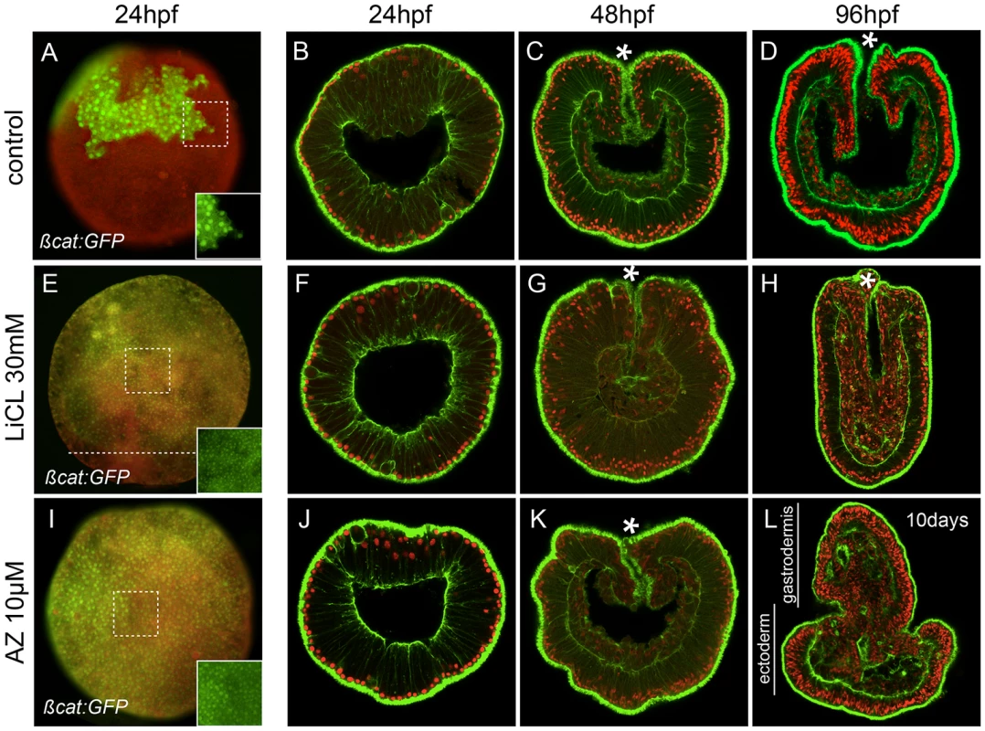 Ectopic activation of canonical Wnt signaling.