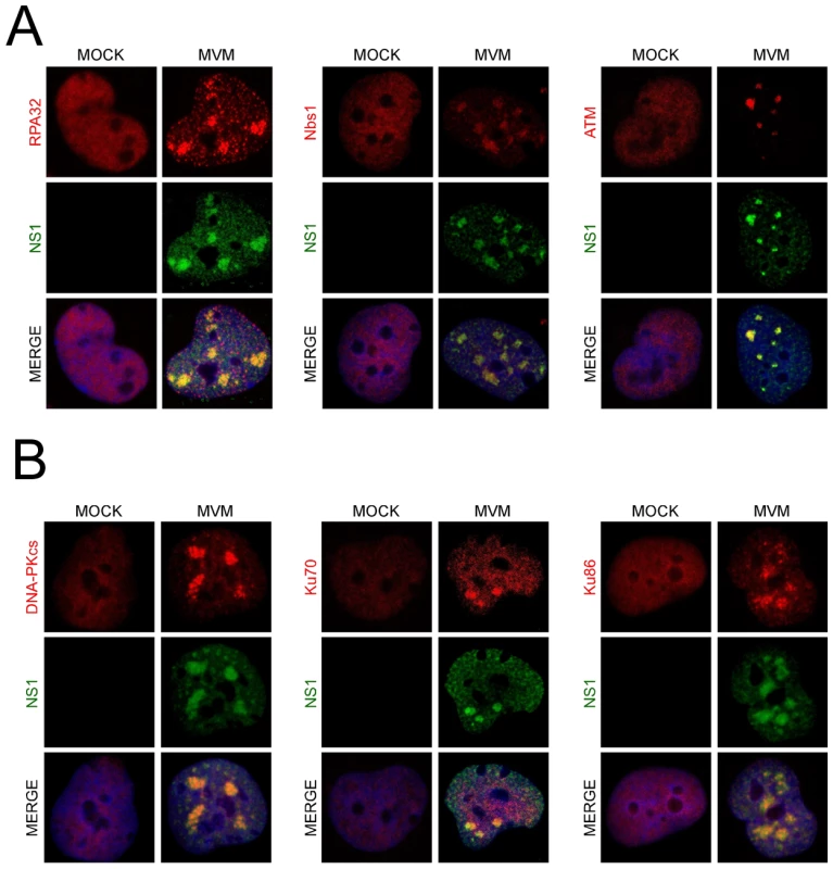DNA repair proteins accumulate at MVM APAR bodies.