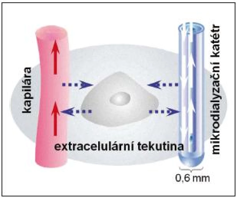 Princip funkce mikrodialyzačního katétru. Mikrodialyzační katétr s dvojitým lumen napodobuje funkci cévy při výměně metabolitů s extracelulárním prostředím CNS.