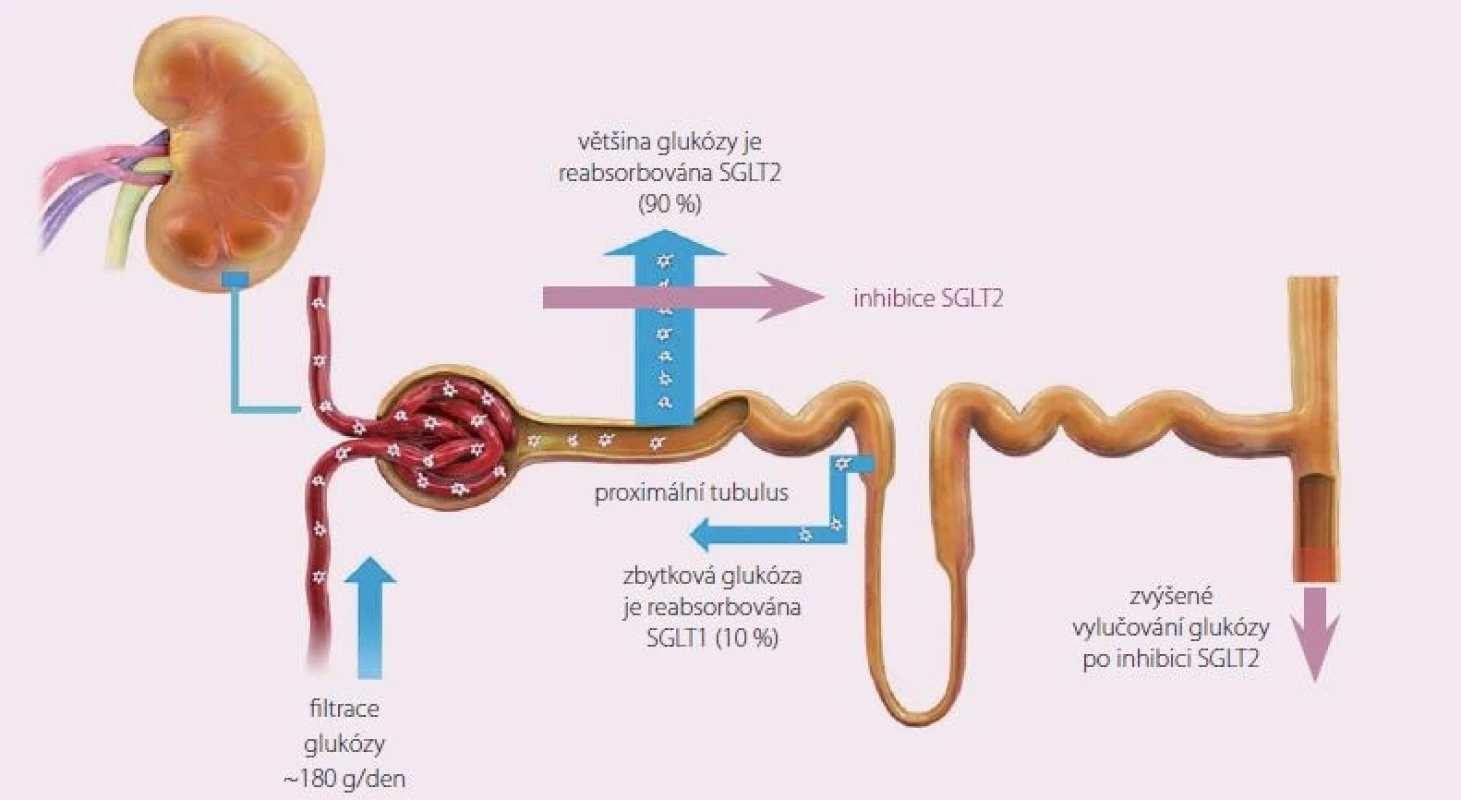 Mechanizmus účinku gliflozinů – inhibitorů SGLT2.