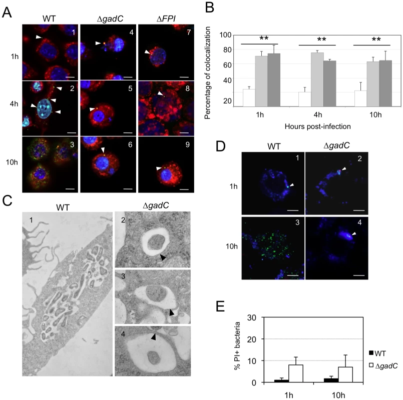 Subcellular localization of the Δ<i>gadC</i> mutant.