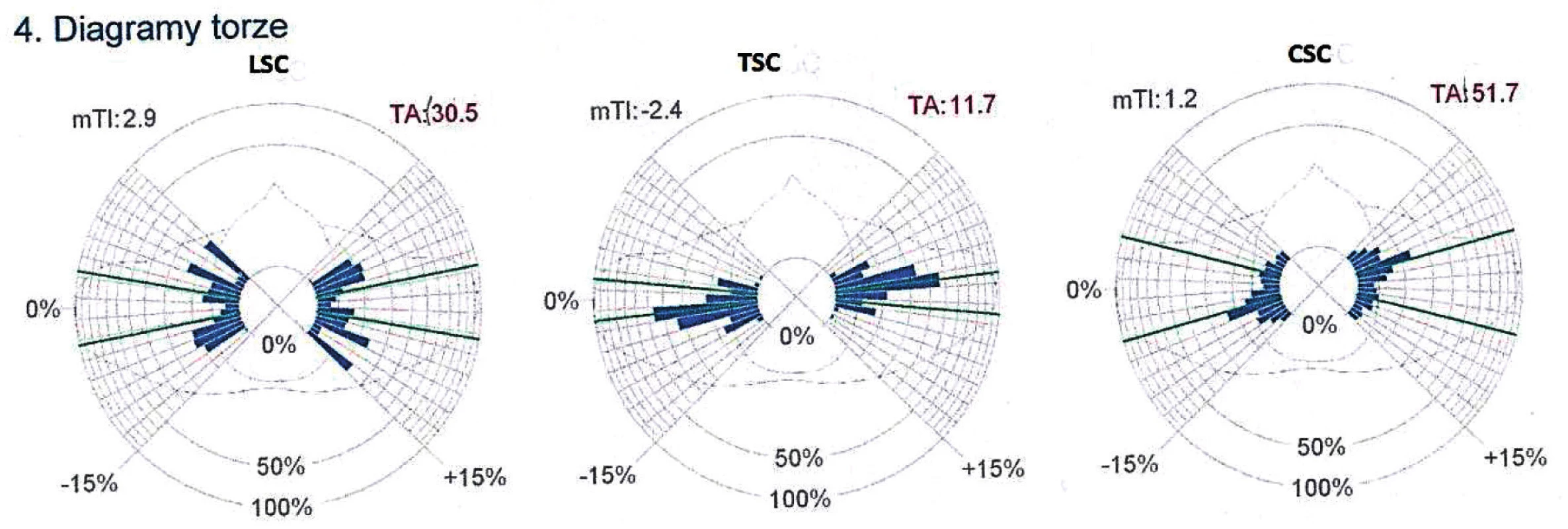Torzný diagram – chôdza s dieťaťom na rukách.