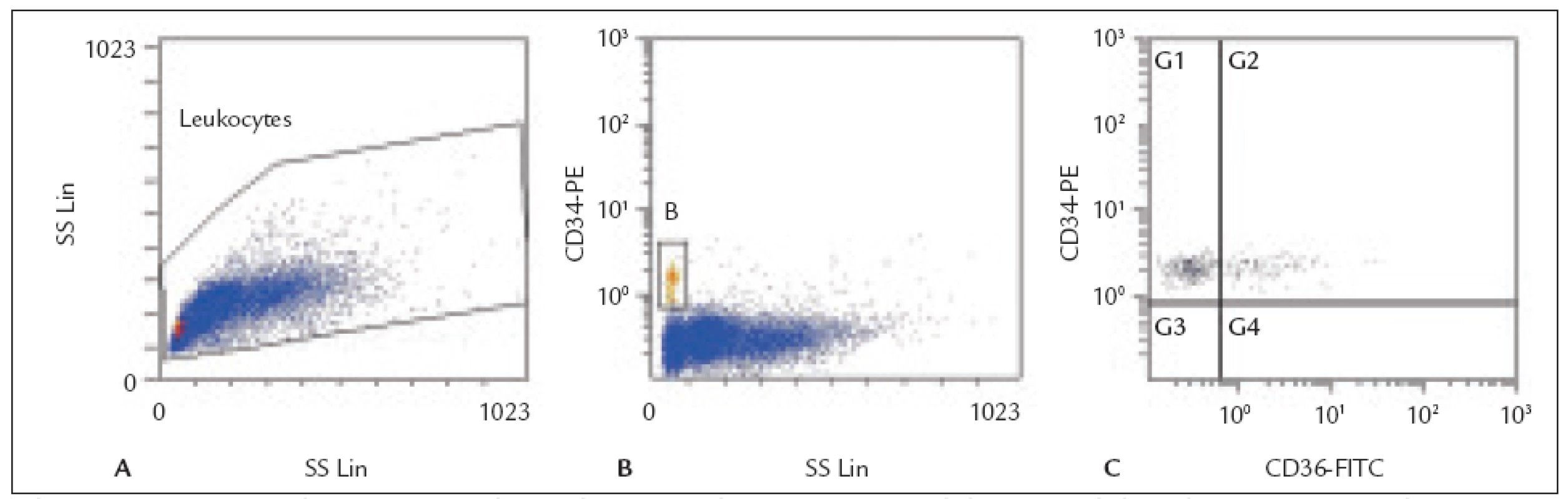 Histogramy z flow cytometrické analýzy transplantátu periferních kmenových buněk (PBSC).
A: Leukocyty – gating na histogramu forward-scatter (FS) vs. side-scatter (SS). 
B: CD34<sup>+</sup> buňky (gate B) identifikované na histogramu CD34 PE vs. side-scatter (SS). 
C: Exprese antigenu CD36 na CD34<sup>+</sup> buňkách – histogram CD34 PE vs. CD36 FITC (subpopulace
CD34<sup>+</sup>36<sup>+</sup> buněk se nachází v kvadrantu G2).