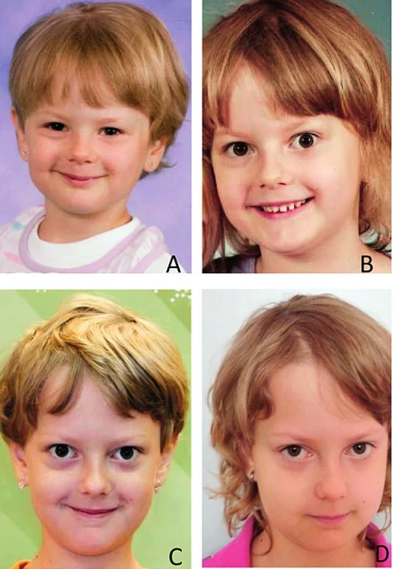 A, B, C, D