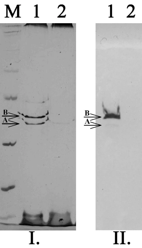 SDS-PAGE (I.) a detekce porinů pomocí specifických protilátek (II.) u kmenů K. pneumoniae. M – standard molekulových hmotností, 1 – kmen citlivý ke karbapenemům exprimující oba hlavní poriny (OmpK35 – A, OmpK36 – B), 2 – kmen rezistentní ke karbapenemům velmi slabě exprimující pouze OmpK35
Fig. 3. SDS-PAGE and Western-blott detection of porins in K. pneumoniae strains. M – marker of molecular weight, 2 – strain susceptible to carbapenems expressed both main porins (OmpK35 – A, OmpK36 – B), 2 – strain resistant to carbapenems expressed only OmpK35 in very low level