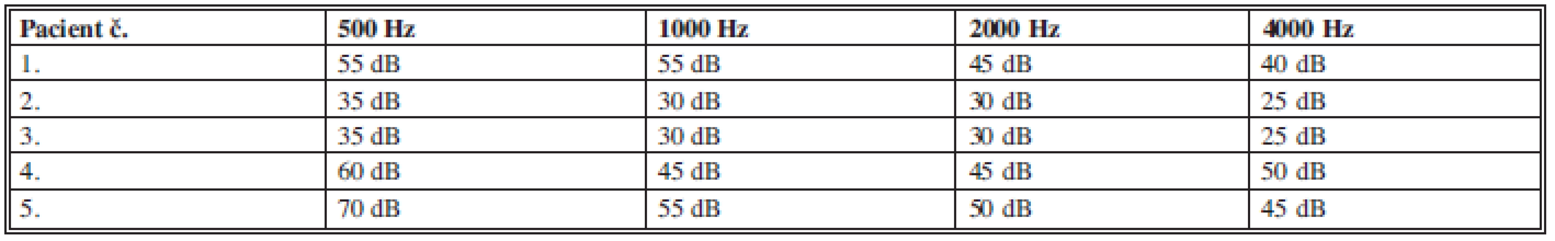 Zisková křivka ve frekvencích 500 - 4000 Hz.