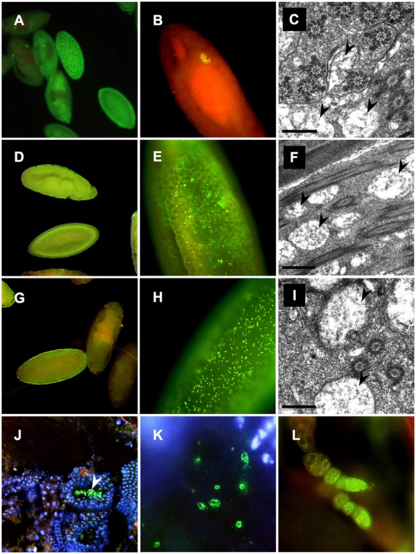 Distribution of <i>Wolbachia</i> during development of <i>D. paulistorum</i> semispecies.