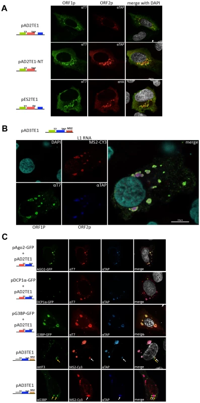 Cellular identification of L1 cytoplasmic foci.