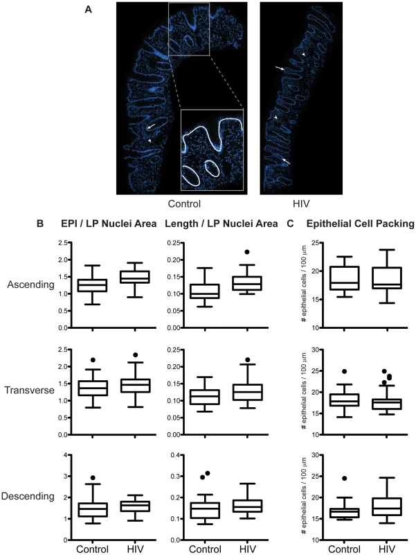 Relative abundance of epithelial cells in intestinal biopsies is not decreased in HIV+ individuals.