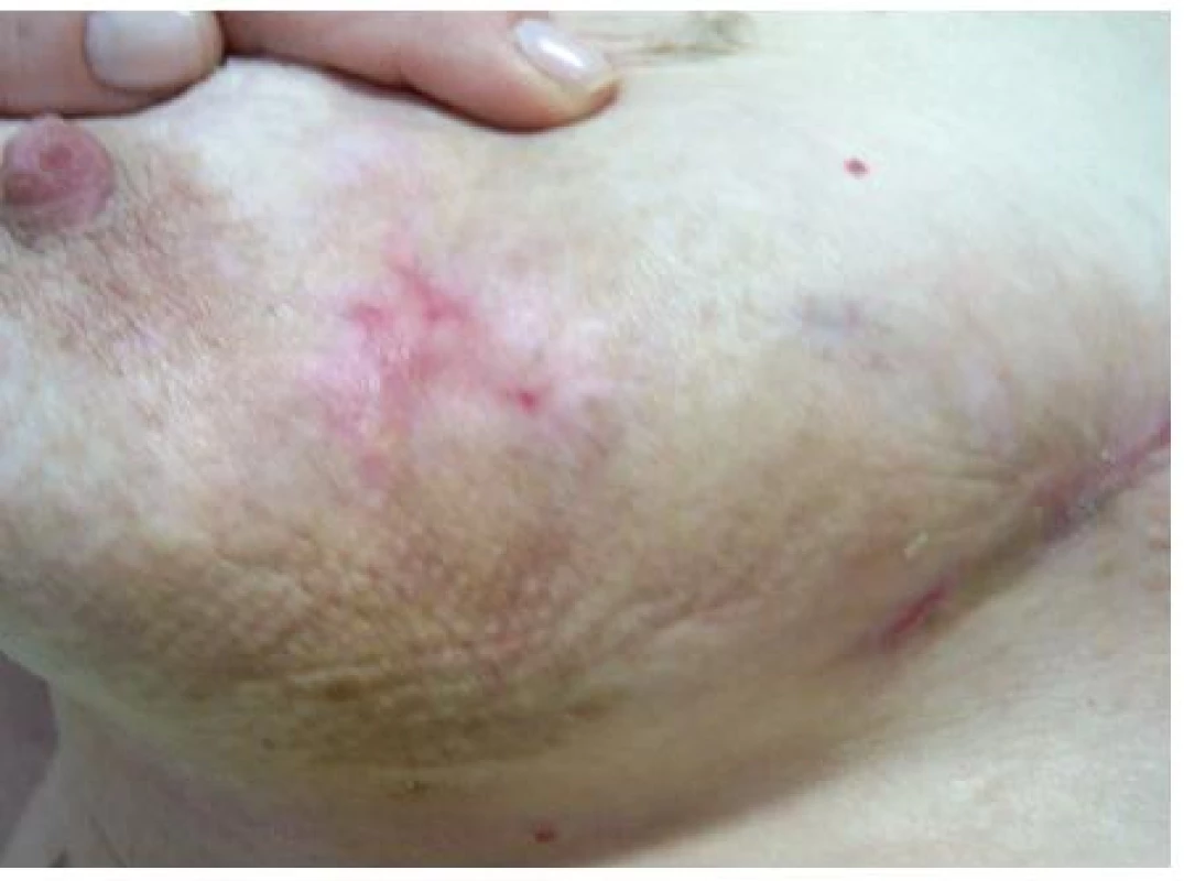 Klinický stav po 6 týdnech léčby (HE, zvětšeno 40×)