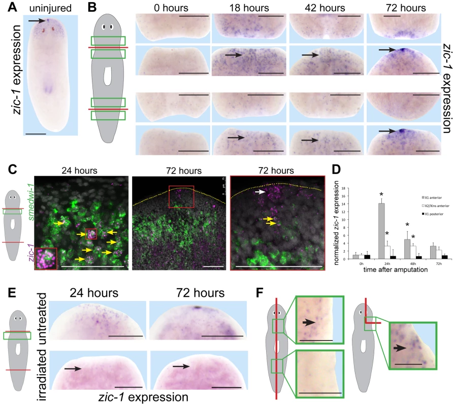 Injury induces expression of <i>zic-1</i> in neoblasts and in the regenerating anterior pole.