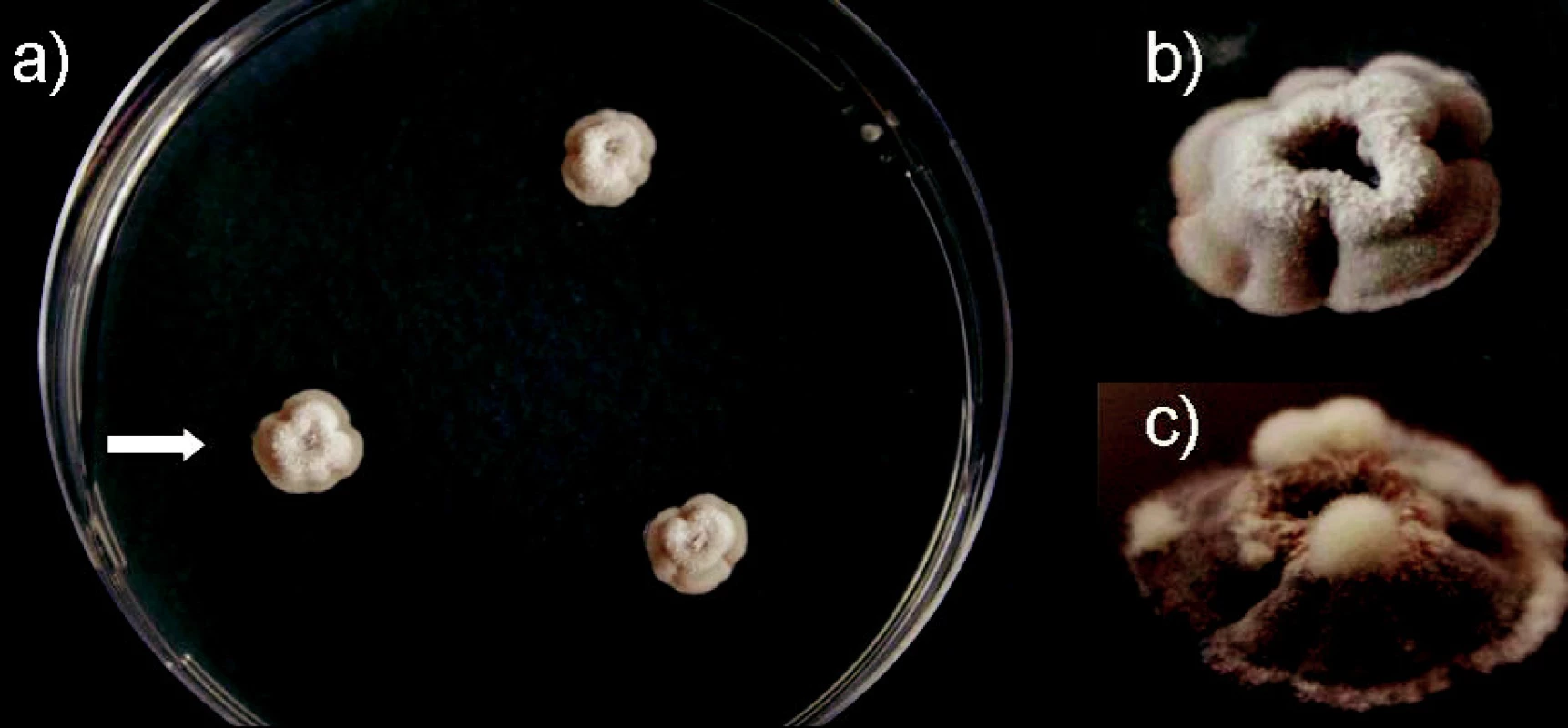 a, b, c. Onychocola canadensis, subkultúry (Sabouraudov agar, 25 °C); a) 3-týždňové, priemer kolónií 8-10 mm, b) 5- týždňová kolónia, detail, skutočná veľkosť 12 mm, c) zhodná 10-týždňová kolónia, detail, priemer 21 mm (foto Ing. K. Furdíková)
Fig. 3 a, b, c. Onychocola canadensis, subcultures (Sabouraud agar, 25 °C); a) 3-weeks colonies, 8-10 mm in diameter, b) a 5-week colony, detail, 12 mm in diameter, c) the same colony at 10 weeks, detail, 21 mm in diameter (photo K. Furdíková)