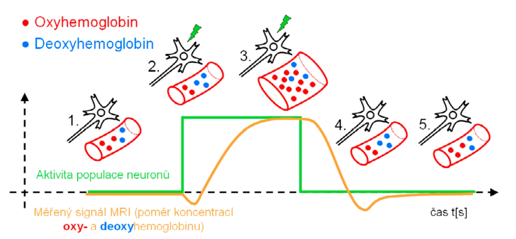Schéma časového záznamu aktivace neuronu, změn prokrvení (perfuze) v jeho blízkosti, změn poměrů koncentrací
oxy- a deoxyhemoglobinu a odpovídajících změn měřeného signálu pomocí MR