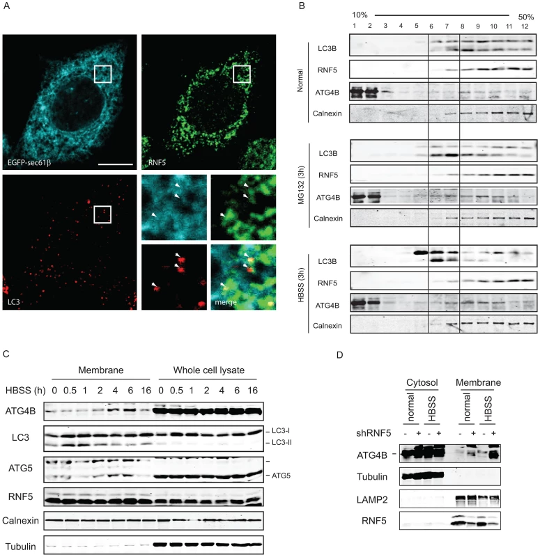 RNF5 co-localizes with—and limits—ATG4B at the membrane compartment.