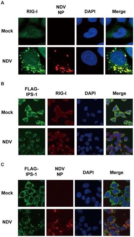 Localization of viral nucleocapsid, RIG-I, and IPS-1.