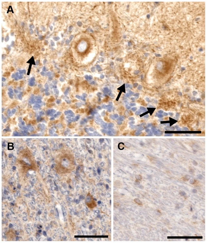 Rab24 immunohistochemical staining of the cerebellum of an affected dog.
