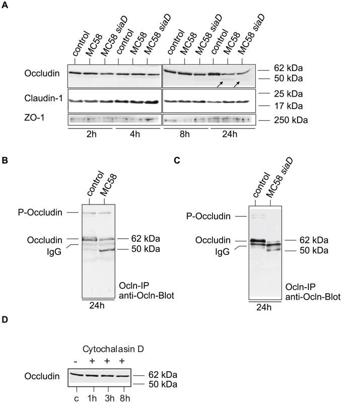 <i>N. meningitidis</i> infection of HBMEC causes degradation of occludin.
