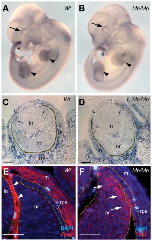 Fibrillin-2<sup>Mp</sup> aggregated into large intracellular inclusions within the rough endoplasmic reticulum.