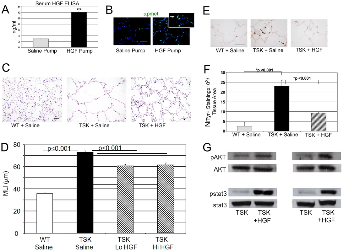 HGF treatment improves airspace caliber in TSK/+ mice.