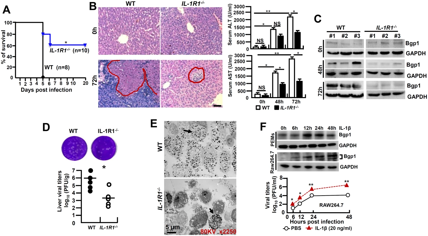 <i>IL-1R1</i> deficiency attenuates MHV-3-induced hepatitis.