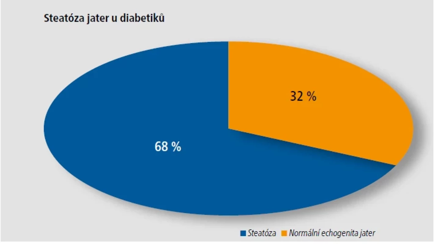 Prevalence jaterní steatózy u diabetiků během jednoho roku na pracovišti na klinice Restrial.