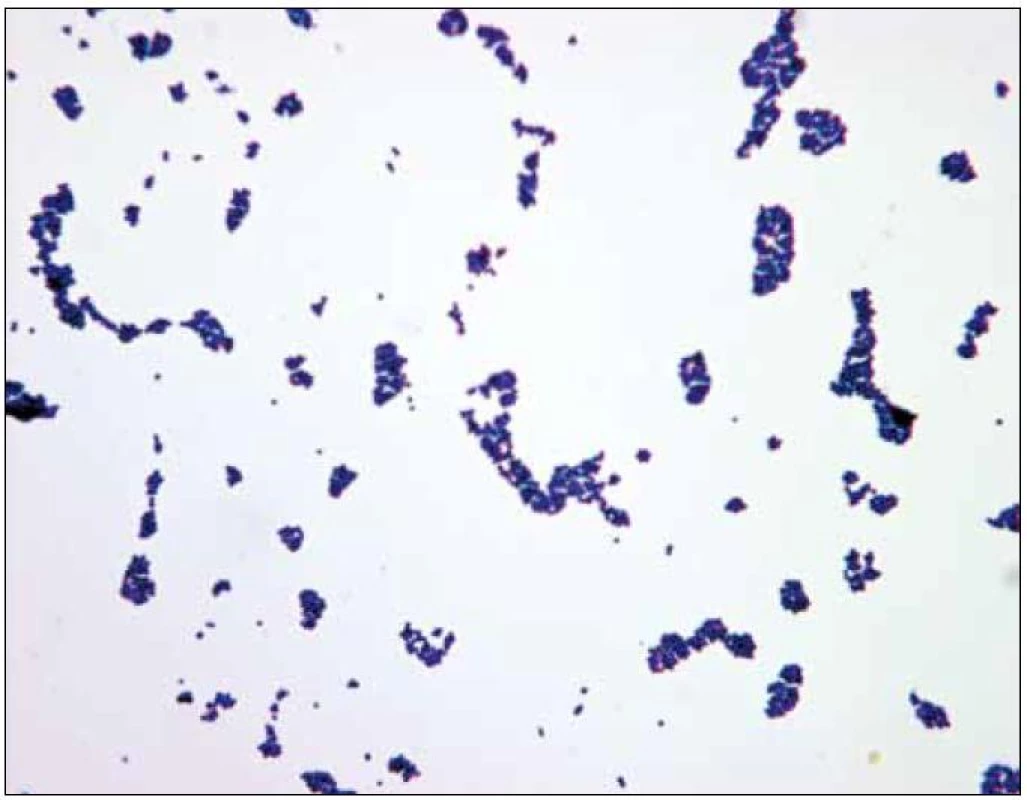 Mikroskopický nález <em>Staphylococcus aureus</em>.