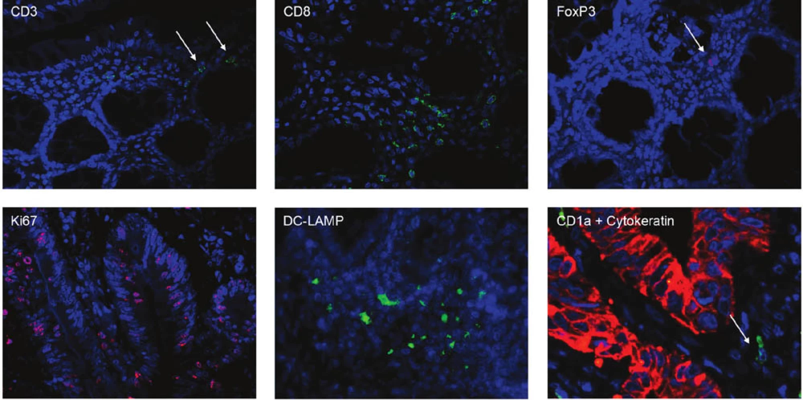 Imunofluorescenční značení parafinových řezů
Fig. 1: Immunofluorescent staining of paraffin sections