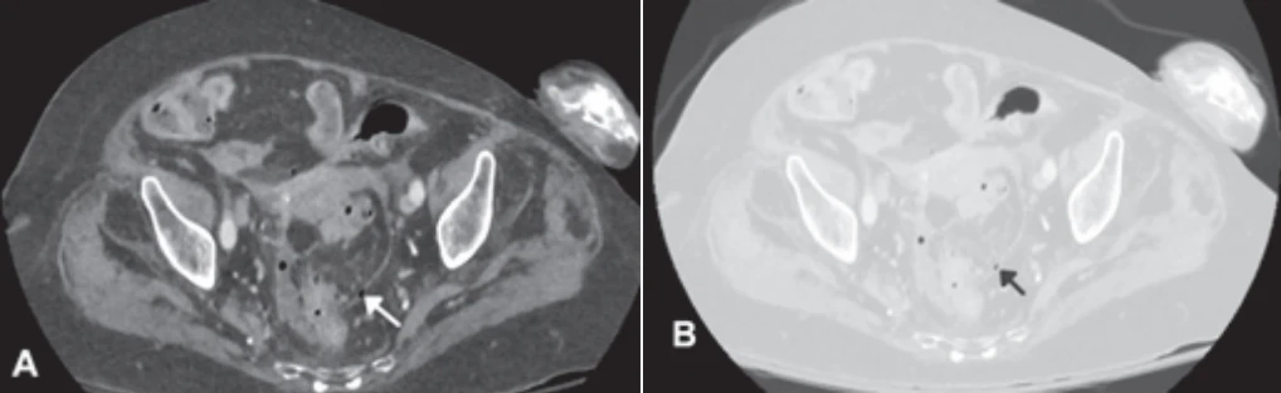  / Fig. 5.