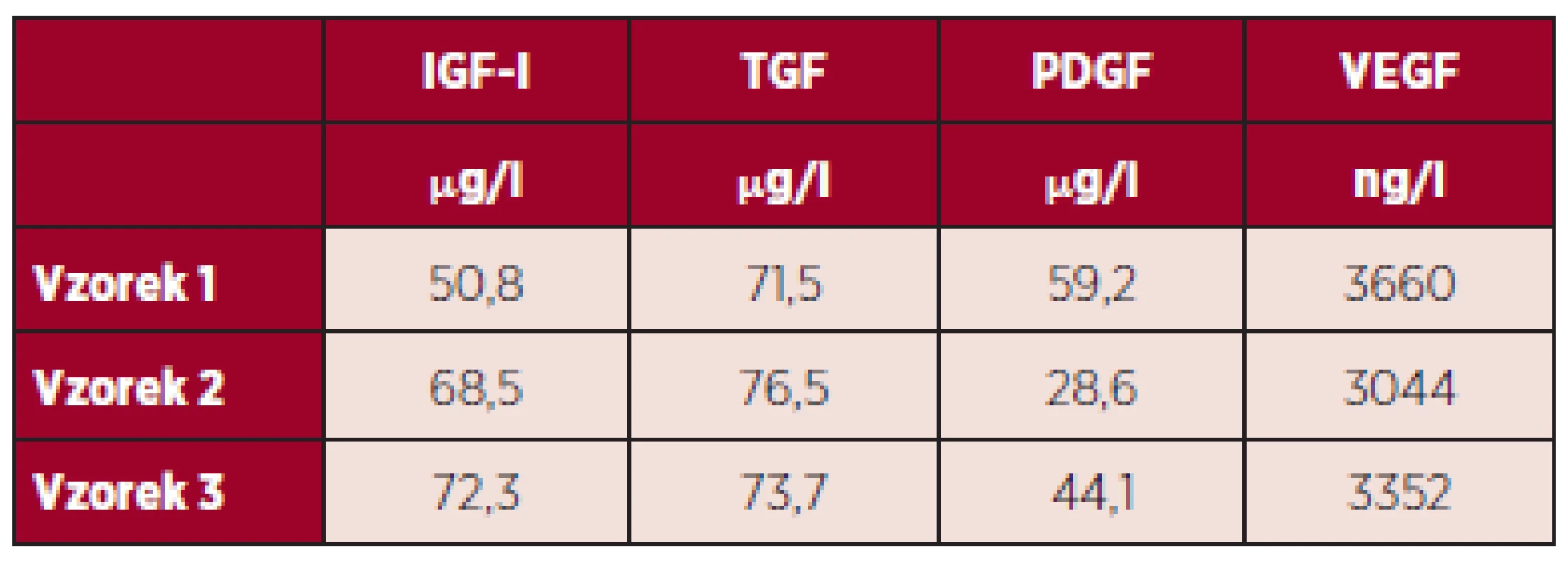 Výsledky měření hladiny vybraných destičkových faktorů v DL po lyofilizaci.