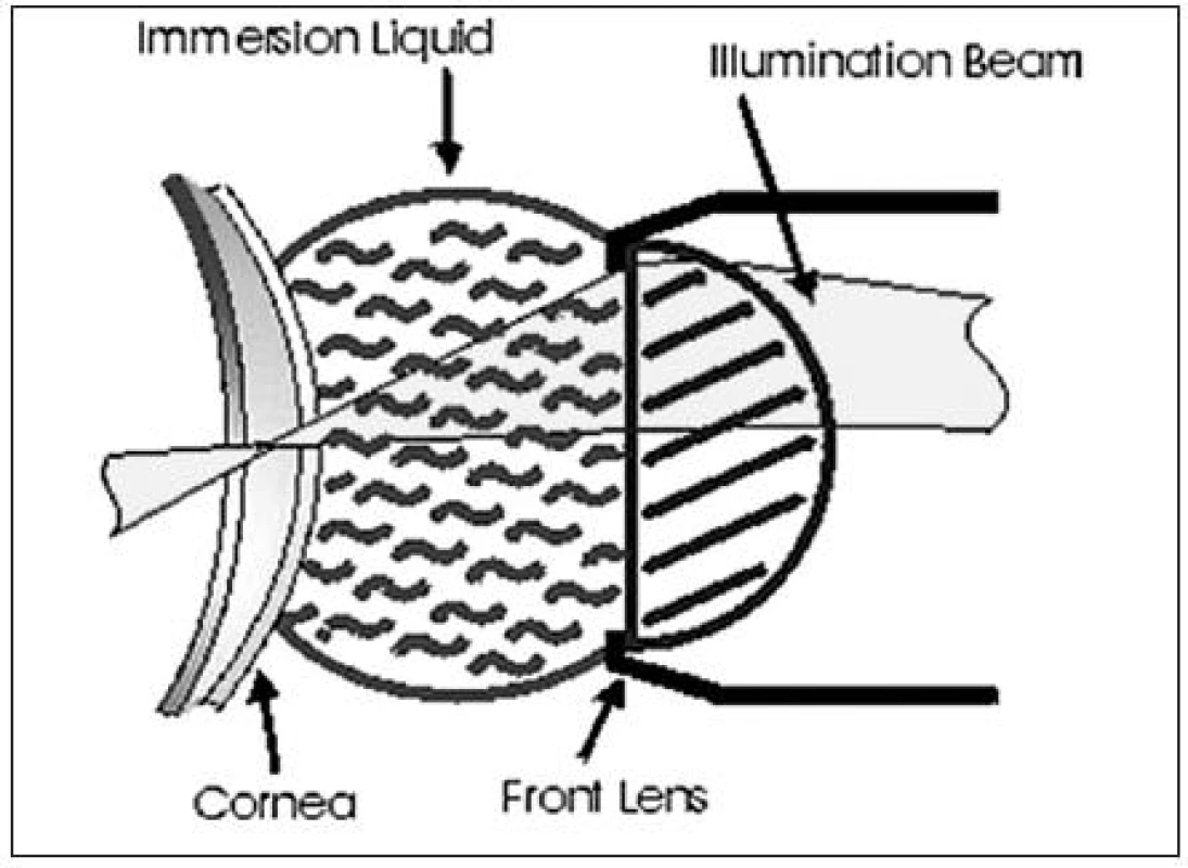 <i>(s povolením Nidek Technologies)</i>