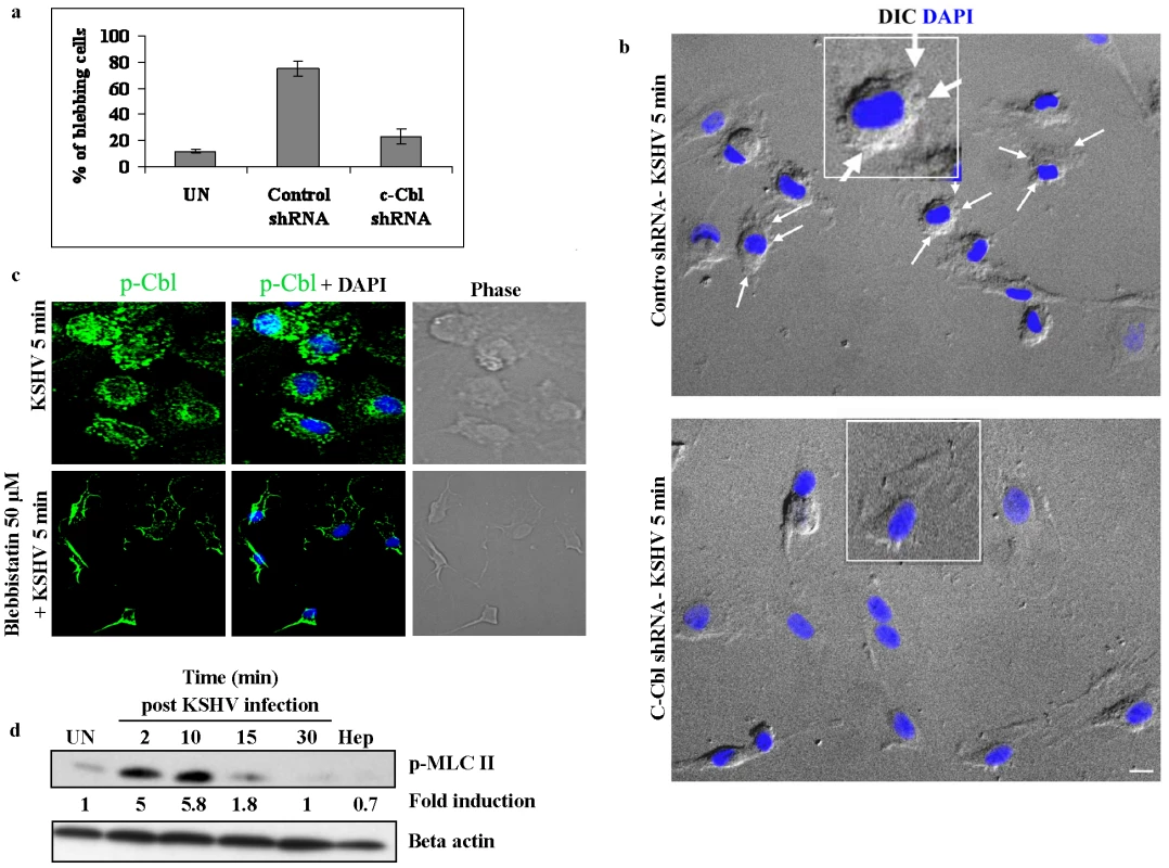 c-Cbl is upstream of myosin IIA in the induction of blebs.