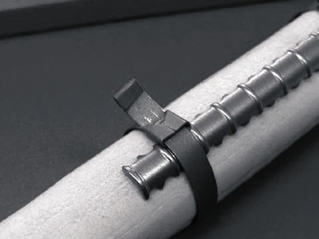 Dlahovou přemosťující syntézu užíváme tam, kde nelze odstranit původní implantát, není zhojena původní zlomenina či původní implantát nedovoluje použití intramedulárního hřebu