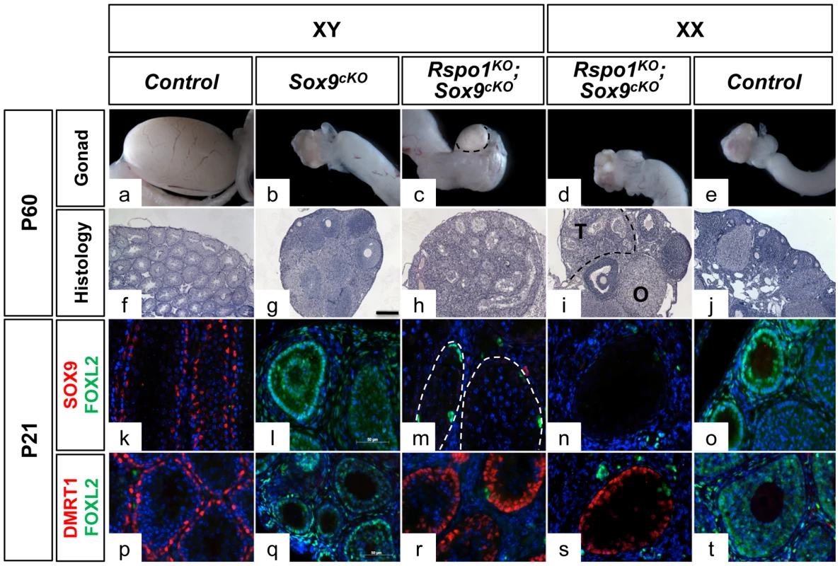 Testicular differentiation in XY and XX <i>Rspo1<sup>−/−</sup>; Sox9<sup>flox/flox</sup>; Sf1;cre<sup>Tg/+</sup></i> (<i>Rspo1<sup>KO</sup>Sox9<sup>cKO</sup></i>) mice.