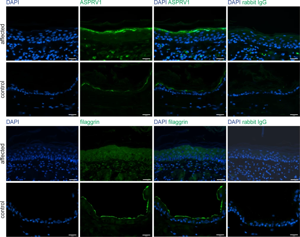 ASPRV1 and filaggrin protein expression.