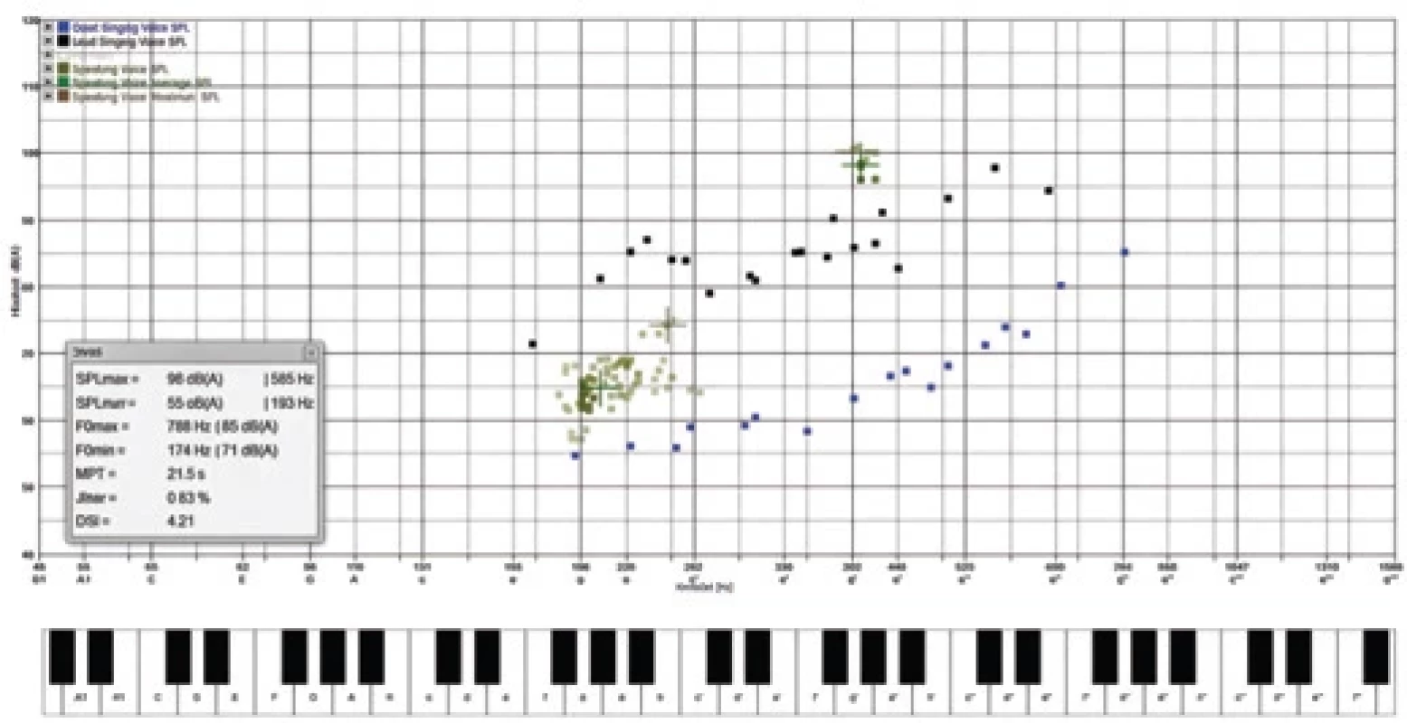 Hlasové pole (VRP – voice range profi le). Žena 53 let, hlasový neprofesionál. Na ose x se zobrazuje frekvence v Hz a korespondující hudební výška tónu, na ose y hladina akustického tlaku (SPL) různých typů fonací v dB(A), měřená ve vzdálenosti 30 cm.