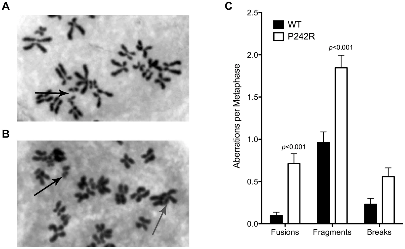 Chromosomal aberrations in P242R-expressing cells.