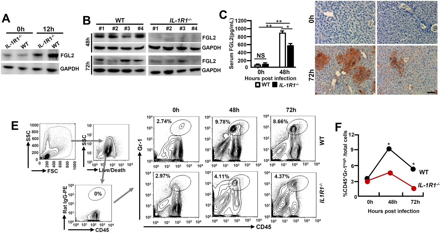 MHV-3 fails to induce FGL2 production and neutrophil infiltration in the livers of <i>IL-1R1</i><sup><i>-/-</i></sup> mice.