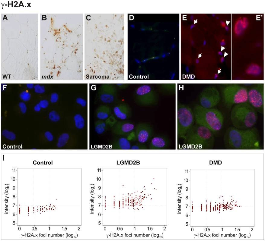 Pronounced DNA damage response in murine and human dystrophic muscle.