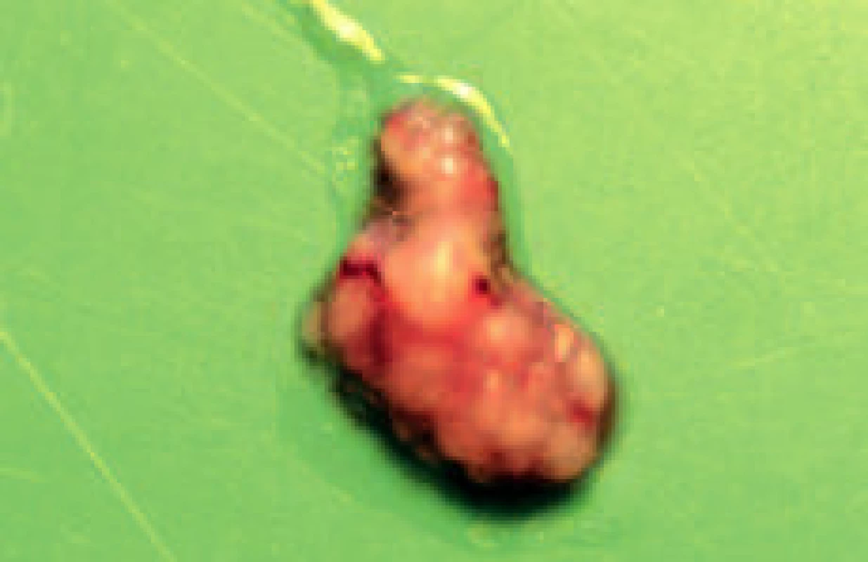 Ledviny čichavce zakrslého (Colisa lalia) s multipními granulomy různé velikosti (foto L. Novotný).